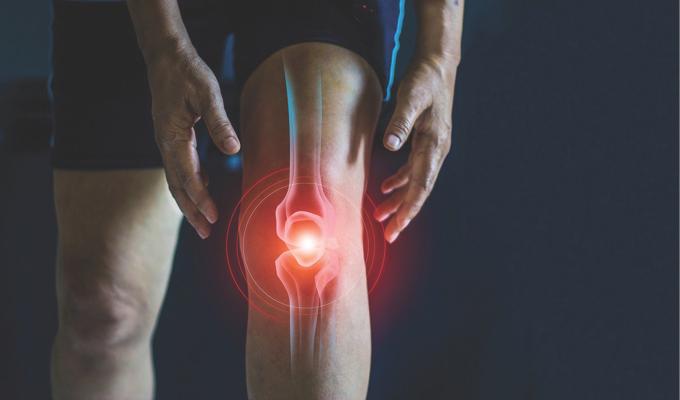 How arthritis affects daily life, mobility